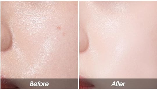 APIEU Cilde Pürüzsüz Görünüm Sunan Hd Mineral Pudra Mineral 100 Hd Powder