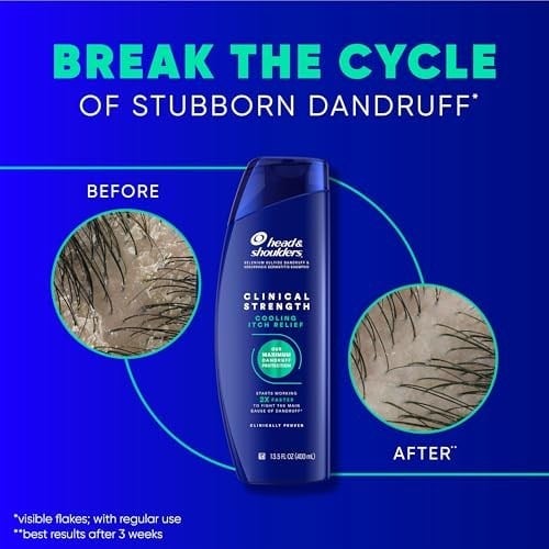 Head & Shoulders Klinik Mukavemet Kepek Şampuanı, Selenyum Sülfür Kepek Savunması, Yoğun Kaşıntı Giderici, Soğutma Mentolü, 13.5 Fl Oz Her Biri, 2li Paket