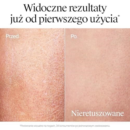 Neutrogena Yoğun Nemlendirici Parfümlü Vücut Losyonu (400 ml)— Kuru ciltler için vücut nemlendiricisi — Pro-Seramid ve Gliserin Teknolojisi ile geliştirilmiş formül