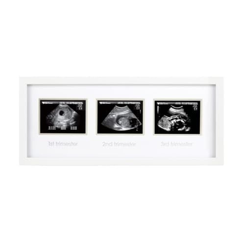 Pearhead 87038 Trimester Sonogram Frame Deluxe, fotoğraf çerçevesi için üç Ultraschallaufnahmen, beyaz