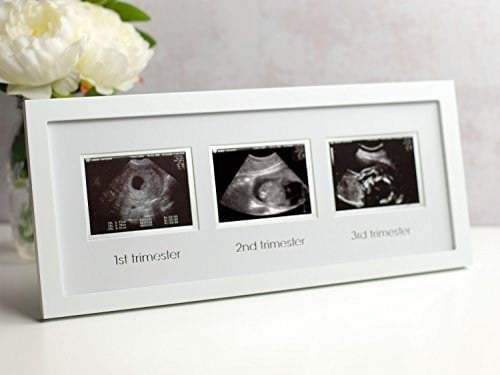 Pearhead 87038 Trimester Sonogram Frame Deluxe, fotoğraf çerçevesi için üç Ultraschallaufnahmen, beyaz