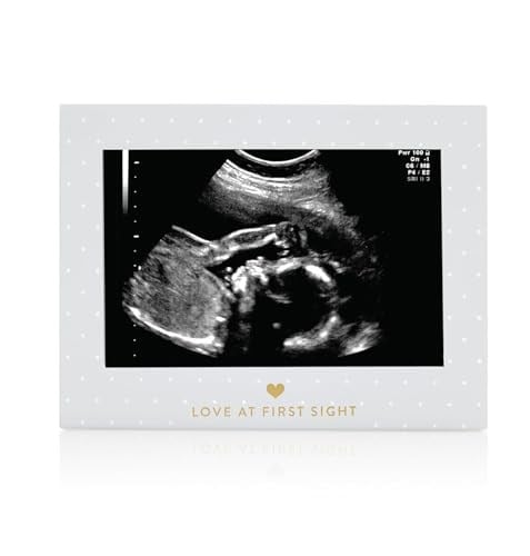 Sonogram Resim Çerçevesi Hamilelik Hatırası, Yakında Kız Bebek veya Erkek Bebek Olacak Cinsiyetsiz Çocuk Odası Dekoru