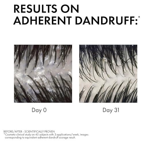 VICHY Dercos Anti Dandruff Kuru Saçlar İçin Kepek Karşıtı Şampuan 200 ml | Salisilik Asit ve Selenyum Sülfür, Kaşıntıyı Yatıştırır, Besler, Dermatolojik