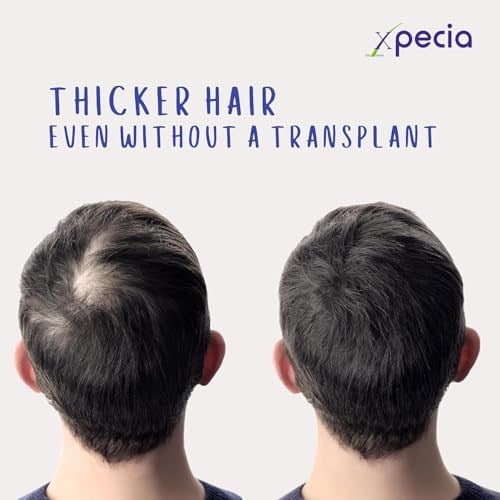 Xpecia Men Original-Vitaminler biotin saw palmetto saç dökülmesi engelleyici DHT saç büyümesi, 1 x 60 adet