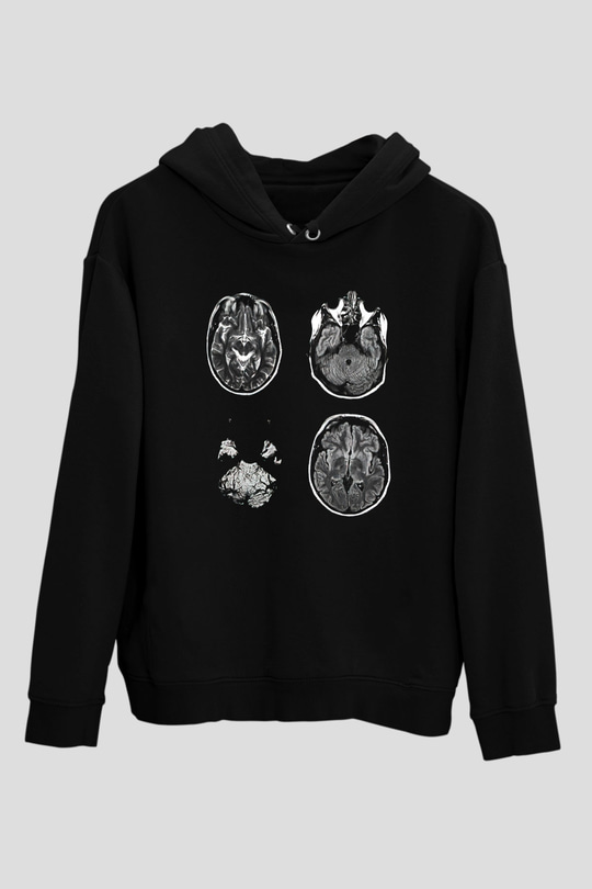 Tıp Bayramı Baskılı Unisex Siyah Hoodie