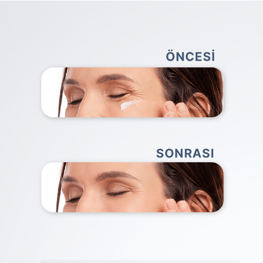 Yoğun Nemlendirici, Kırışıklık ve Koyu Halka Karşıtı Peptit İçeren Göz Çevresi Kremi - 30 ml