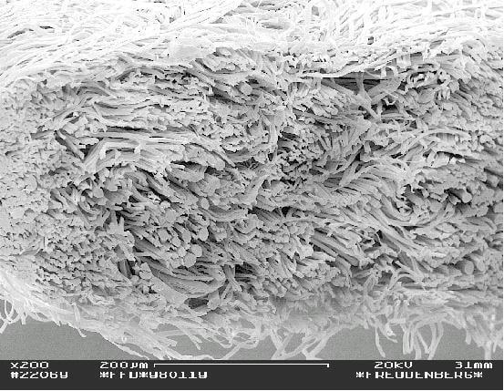 ANTIMITE BEBEK UYKU SETİ