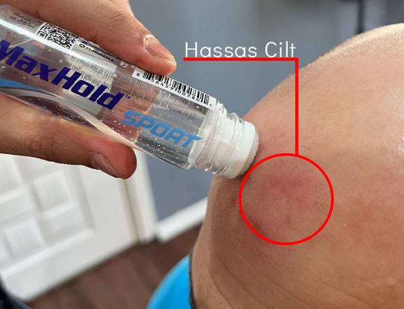 ULTRA HOLD
