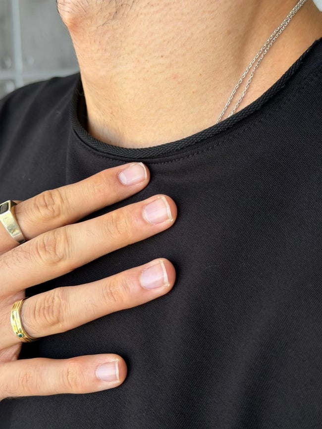 Yan Yırtmaç Detaylı Oversize Uzun Kollu Sweat M - SİYAH