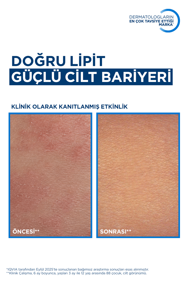 Atoderm AD Intensive Balm Atopik Cilt Kaşıntı Karşıtı Nemlendirici Krem 400 ml