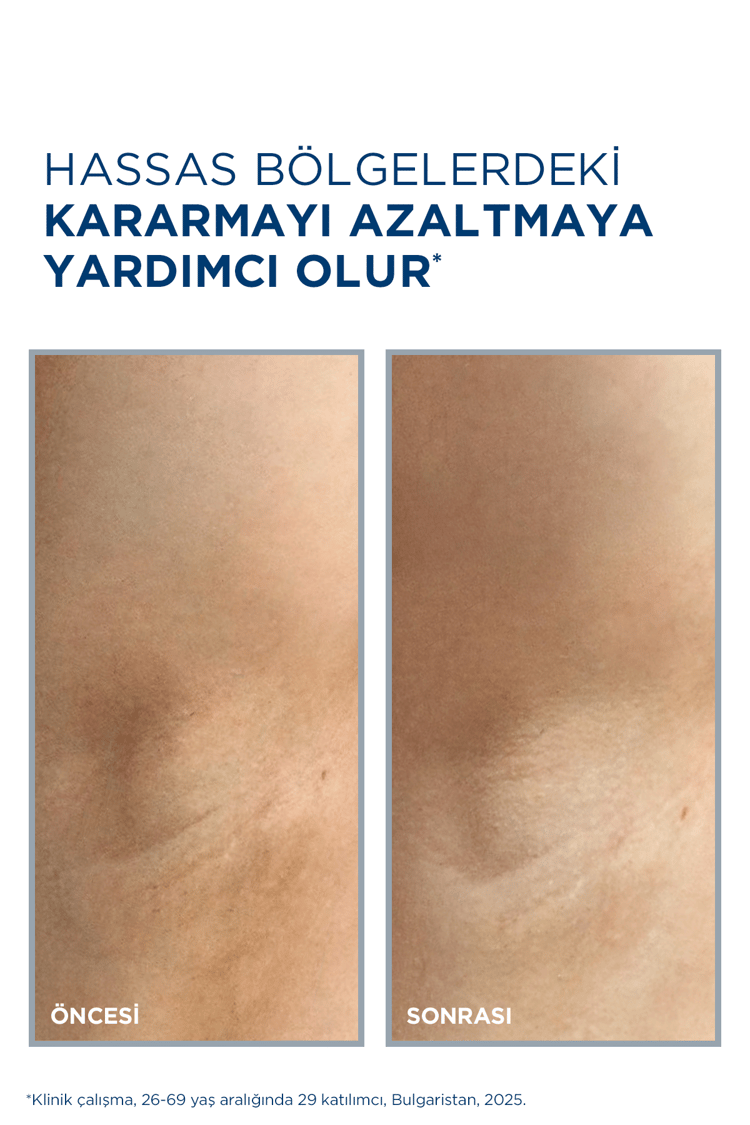Bioderma Pigmentbio Sensitive Areas Genital & Eklem Bölgeleri Aydınlatıcı Bakım Kremi 75 ml