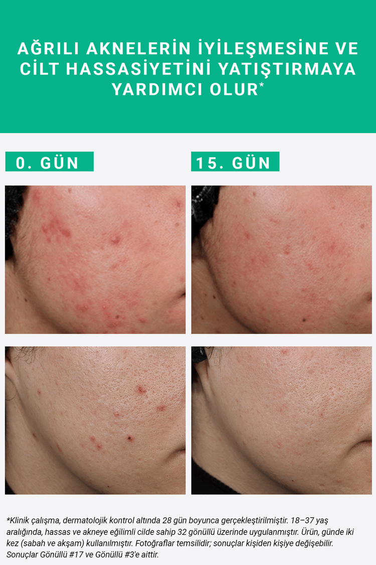 PURE ACTIVE SUCCINIC ACID 15 ML