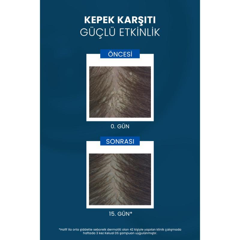 Ducray Kelual DS Şampuan 100 ml