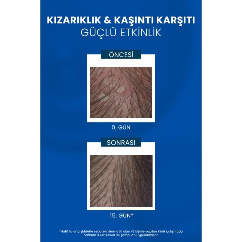 Ducray Kelual DS Şampuan 100 ml