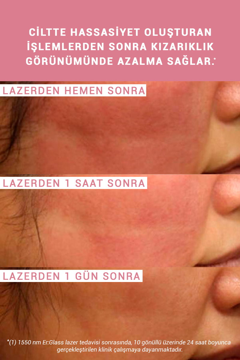 Etat Pur Enoxolone Pure Active Konsantre Bakım Ürünü 15 ml