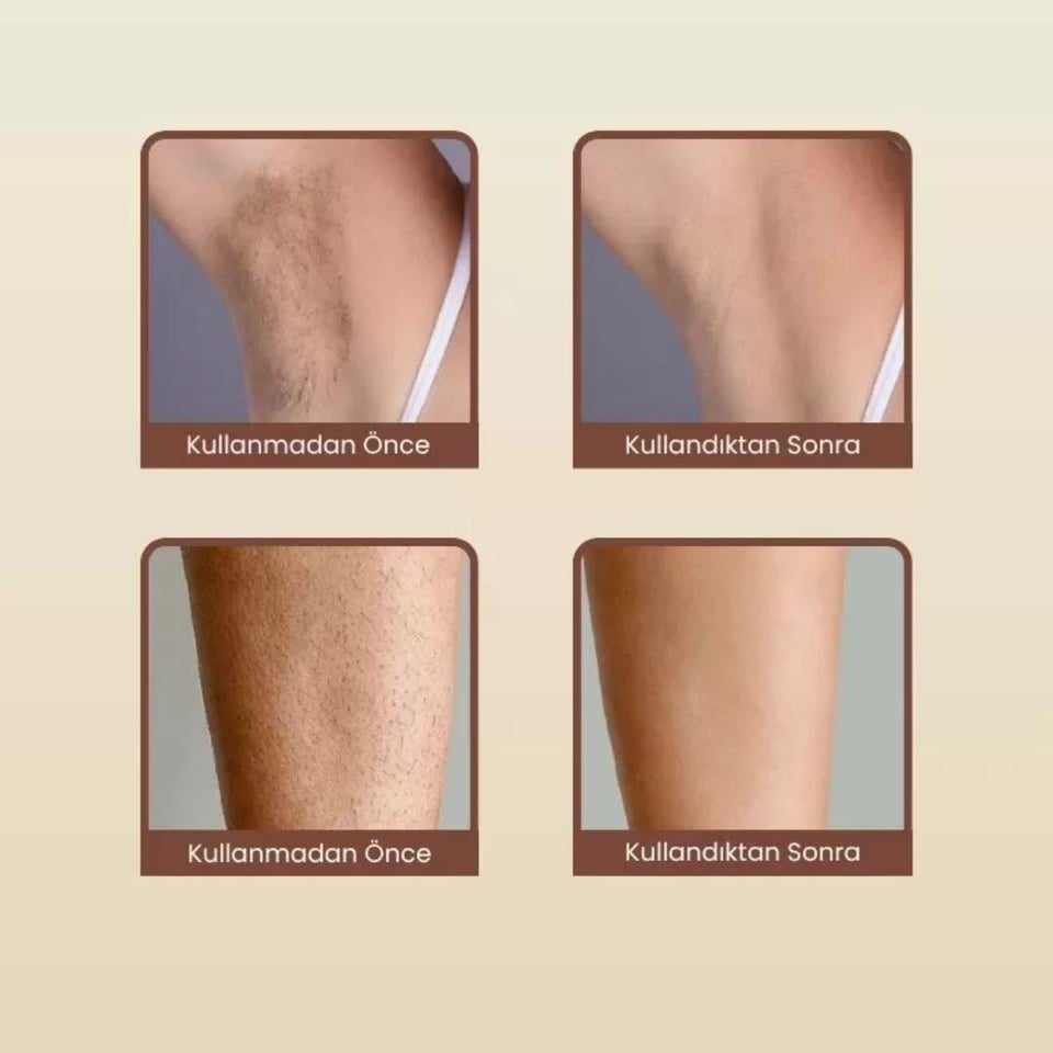 Bekleyen Urun Katalogu Mieco Mieco Sapphire Mor IPL Epilasyon Cihazı